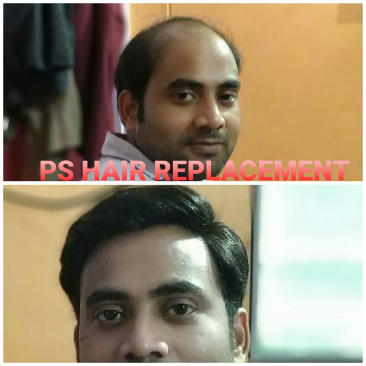 Hair Wigs