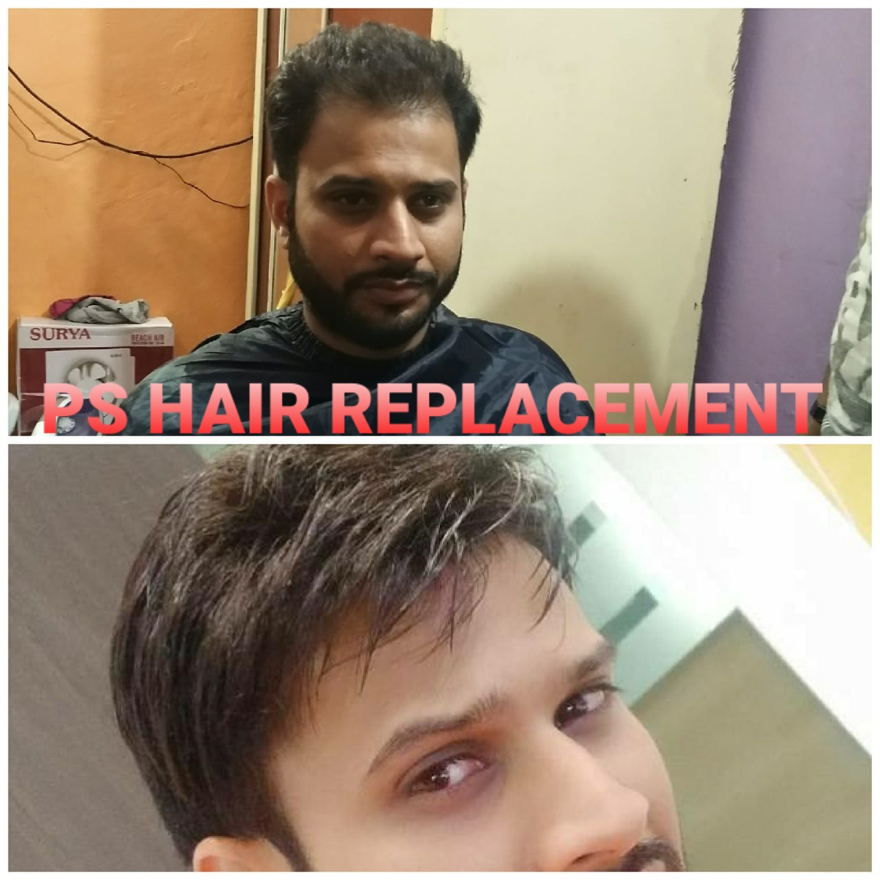 Hair Extensions