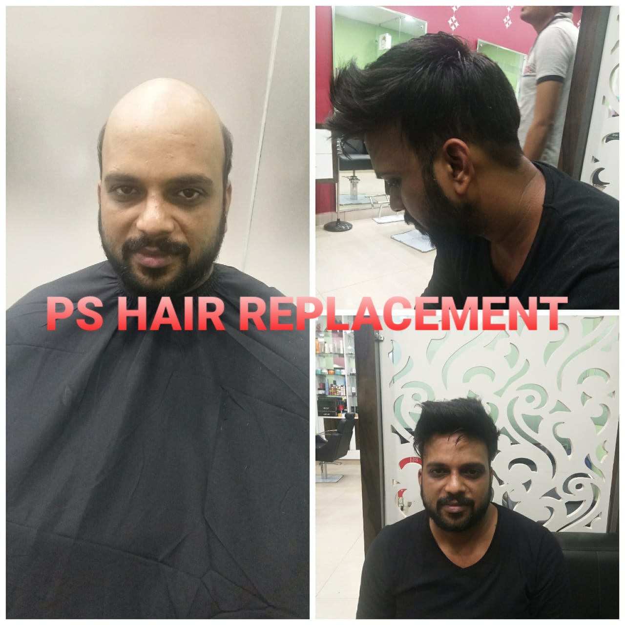 before after