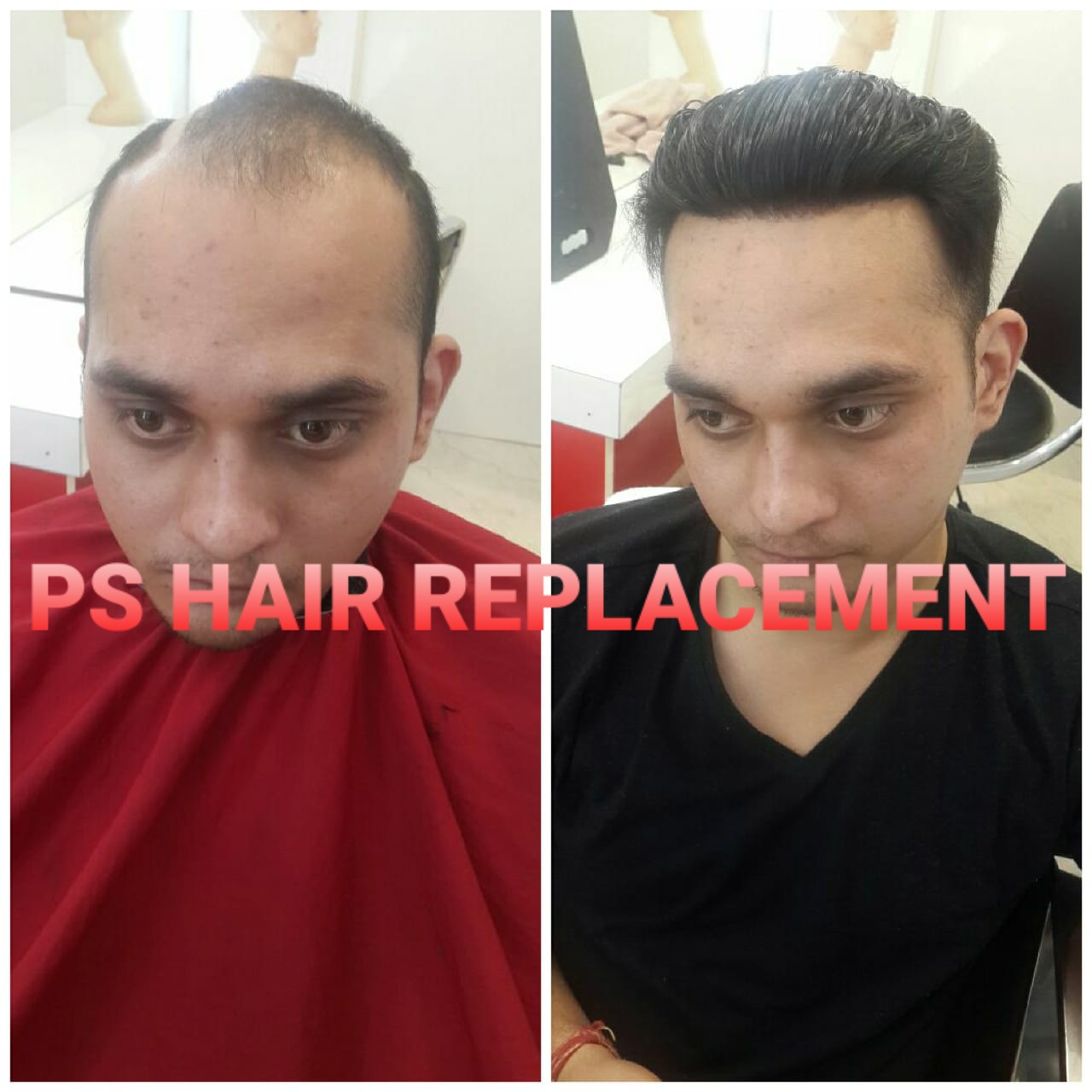 before after