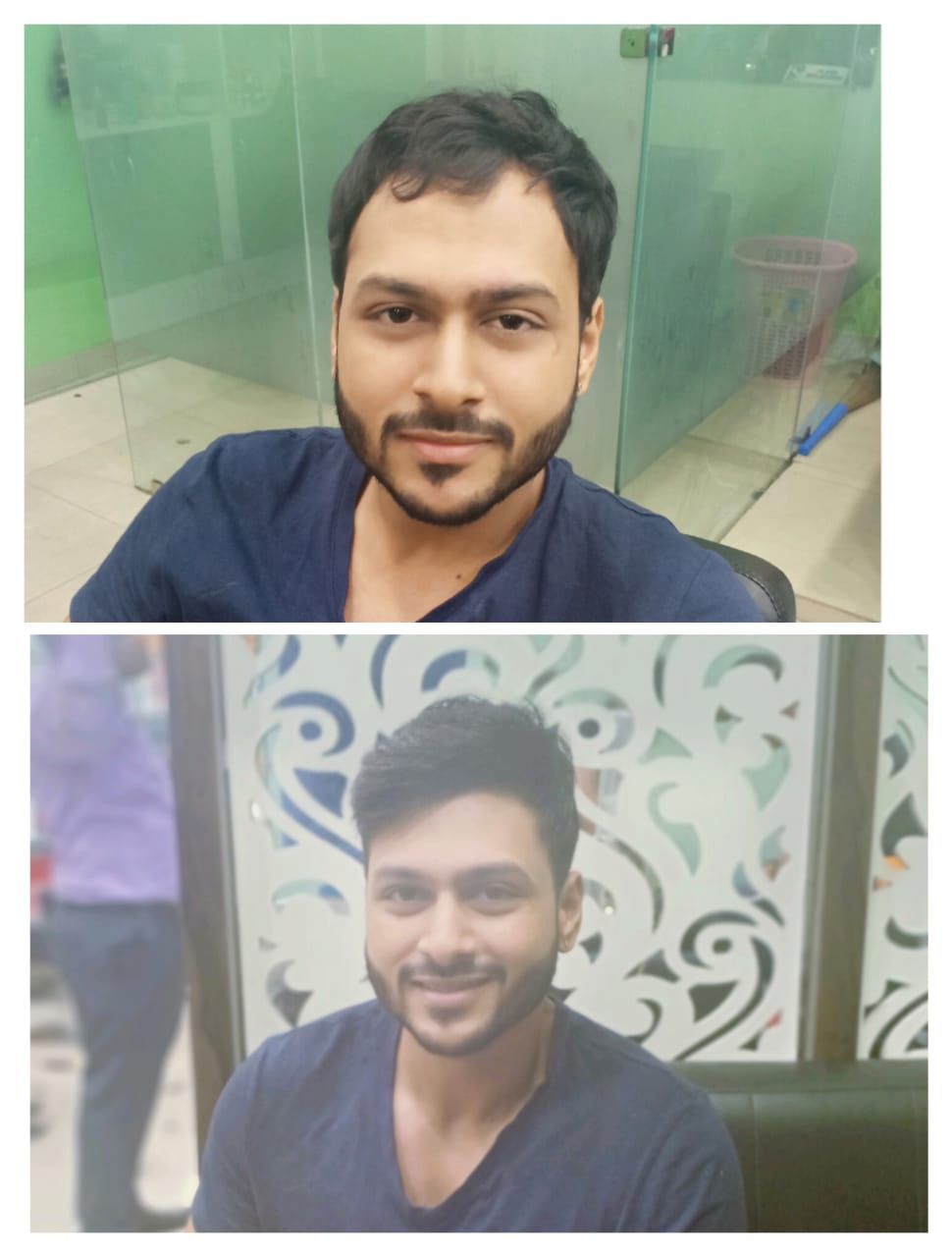 before after